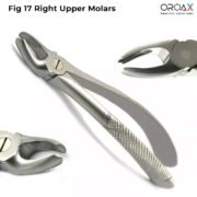 Fig 17 Right Upper Molars - Image 3