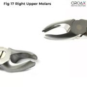 Fig 17 Right Upper Molars - Image 2