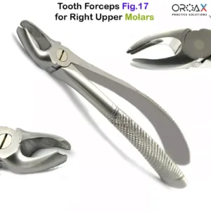 Fig 17 Right Upper Molars