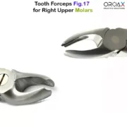 Fig 17 Right Upper Molars - Image 2