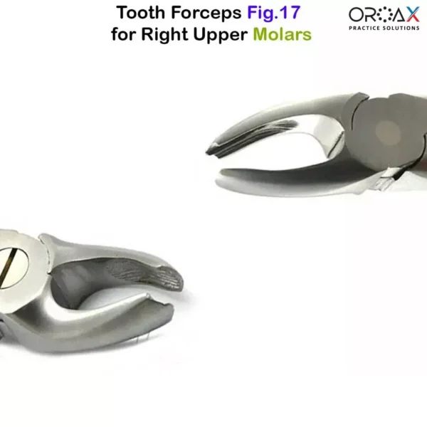 Fig 17 Right Upper Molars