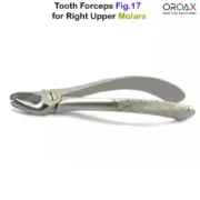 Fig 17 Right Upper Molars - Image 3